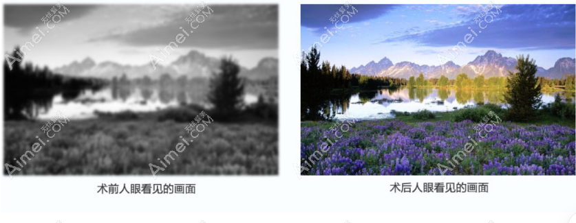 跃无极晶体植入后体验感受