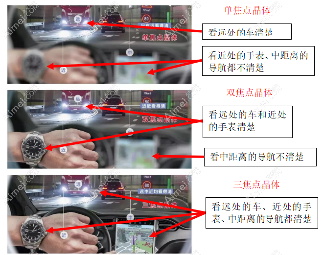 白内障人工晶体单焦、双焦和三焦区别
