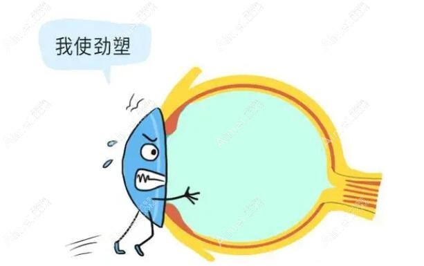 常州角膜塑形镜价格不贵