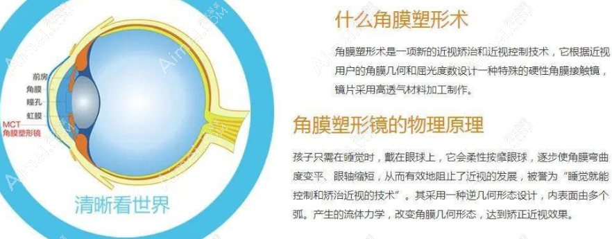 长沙角膜塑形镜价格大概6000元起/副,纳入集采后低至2000元内