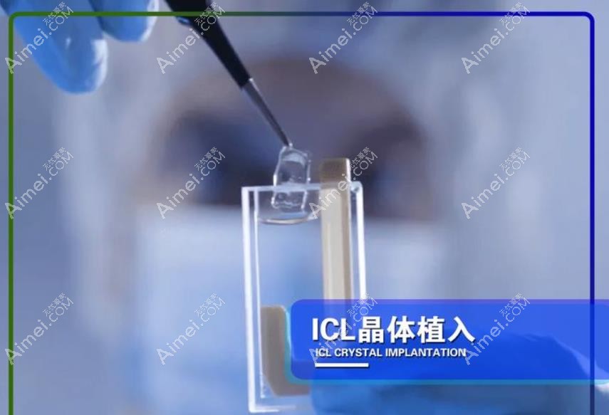 石家庄复明眼科医院icl晶体