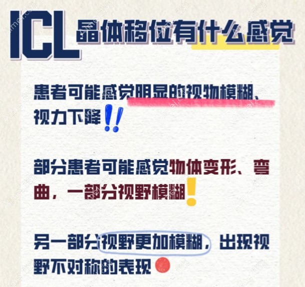 icl人工晶体移位有什么感觉