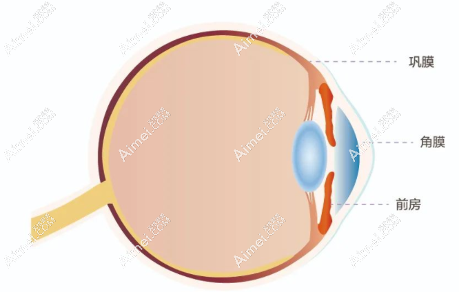 角膜移植手术需要排队但不用配型,单眼角膜移植价格2.5万起