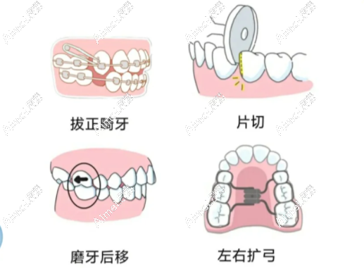 连锁牙科正畸技术可靠