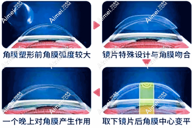 广州常春藤眼科治儿童近视眼靠谱