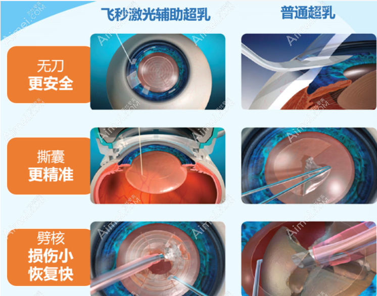 深圳爱尔眼科医院白内障手术怎么样m.aimei.com