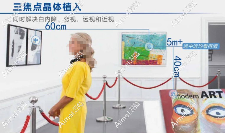 蔡司839mp三焦点人工晶体术后成效