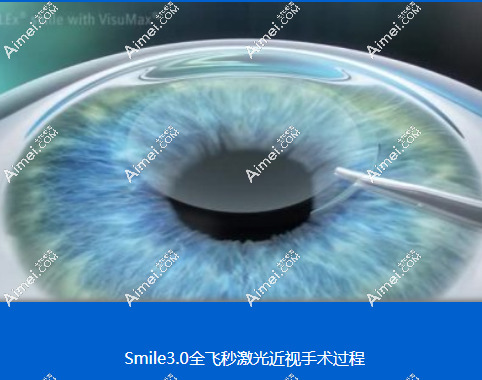 佰视佳眼科做全飞秒近视手术好