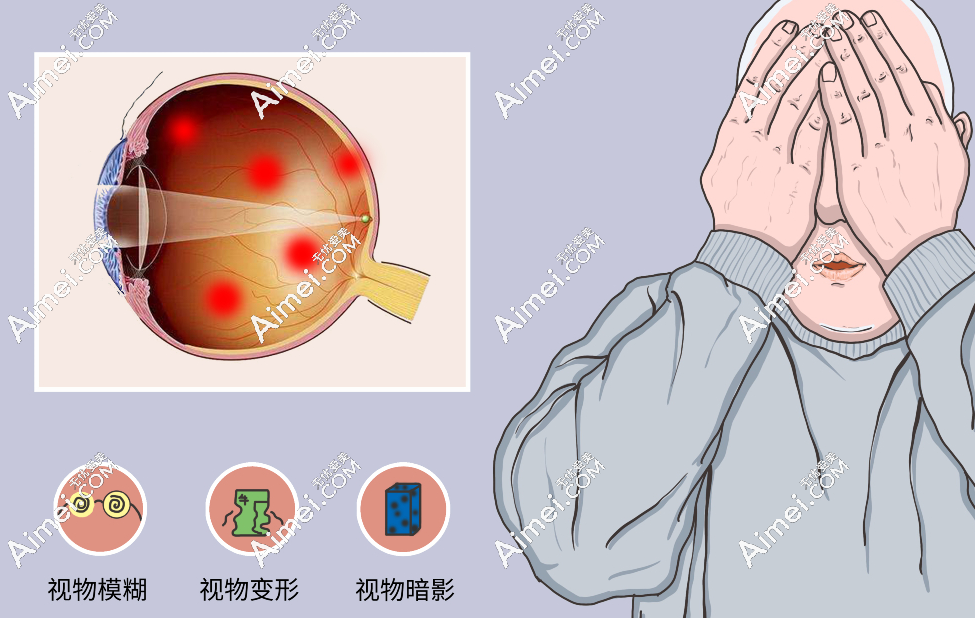 北京民眾眼科醫(yī)院盧寧醫(yī)生做眼底病好