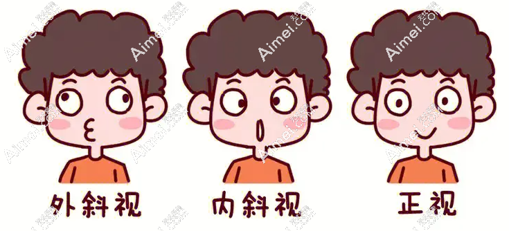 北京民眾眼科醫(yī)院盧煒醫(yī)生做斜視怎么樣