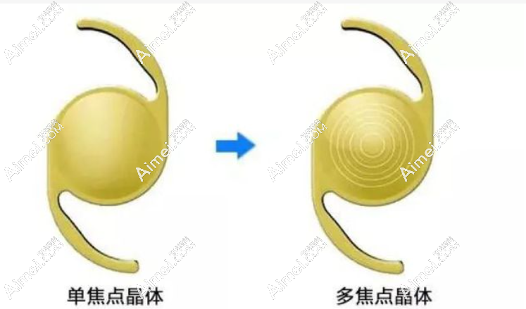 爱尔康sn6at4单焦点非球面人工晶体怎么样