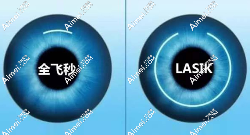 南昌近视眼手术医院前十做手术好