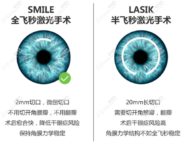 南昌爱尔眼科近视手术收费不贵