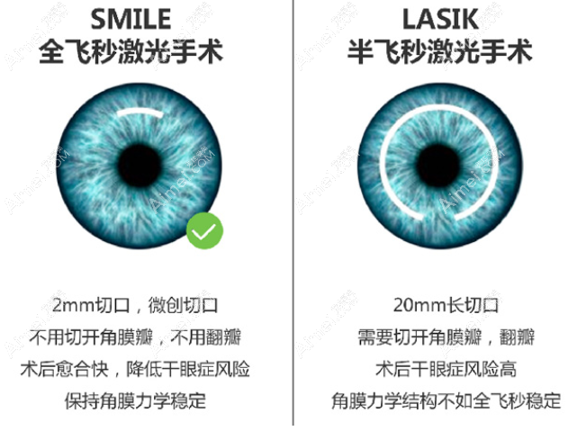 福清亮睛眼科医院做近视眼手术好
