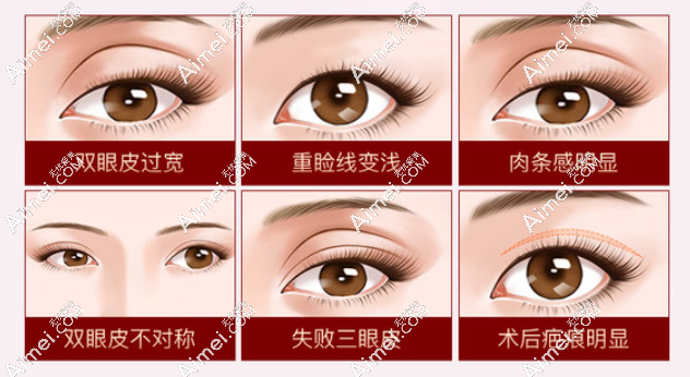 师丽丽和魏志香谁修复双眼皮更好?技术都好,师丽丽擅长宽改窄/魏香眼修复价格不高
