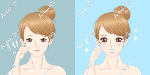 师丽丽和魏志香谁修复双眼皮更好