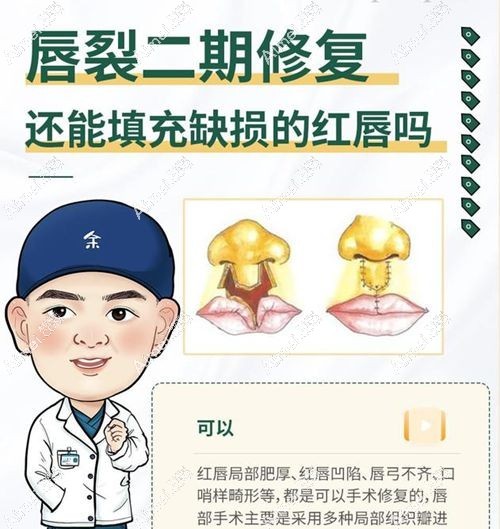 余文林修复嘴唇怎么样