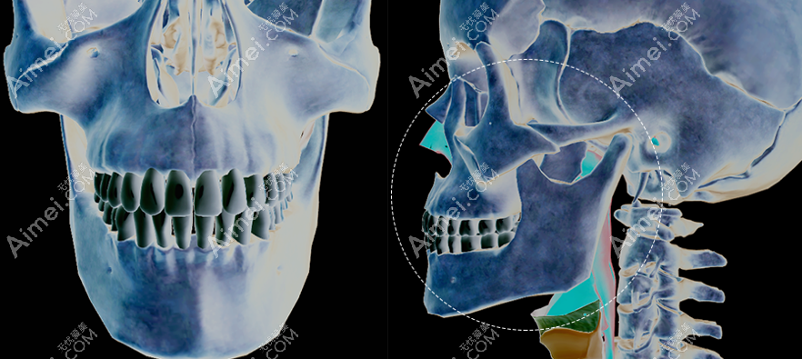 成都罗恩医生磨骨脸不会下垂m.aimei.com
