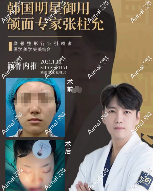 张柱允磨骨技术怎么样