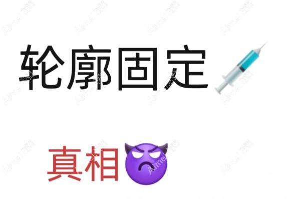 轮廓固定