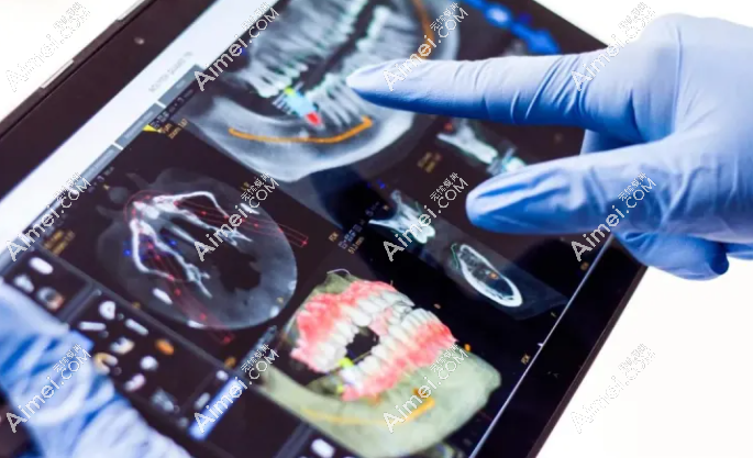 洛阳牙大夫口腔种植牙 洛阳牙大夫口腔种植牙