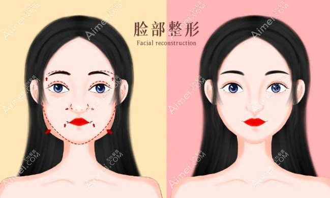 張笑天和黃大勇磨骨手術(shù)技術(shù)對(duì)比