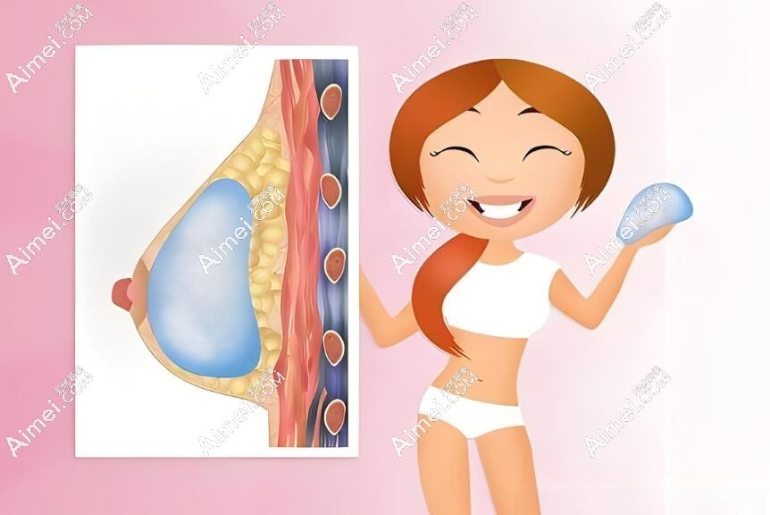假体隆胸医生推荐aimei.com 假体隆胸医生推荐aimei.com