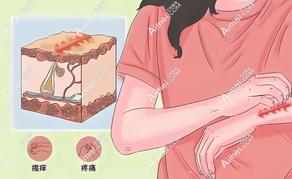 各种疤痕修复aimei.com