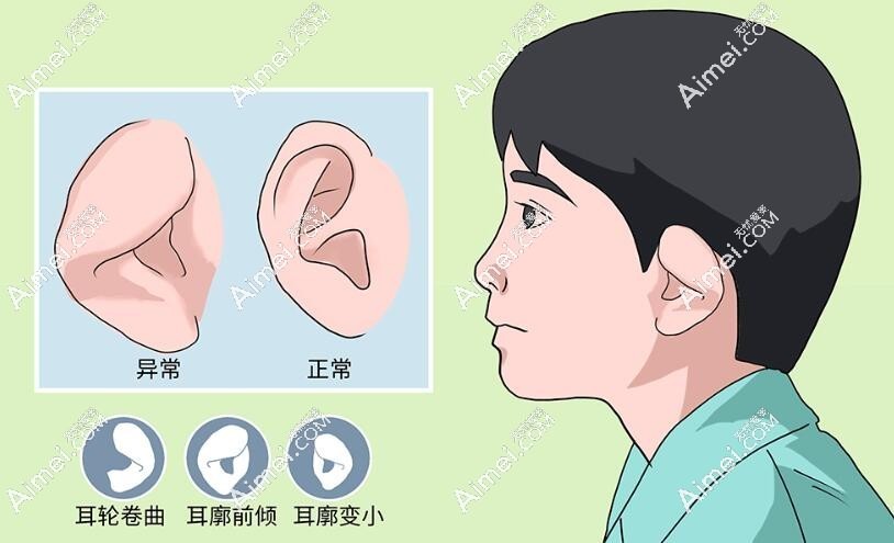 小兒畸形矯正術(shù)aimei.com