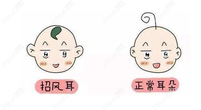 西安耳朵整形需要多少钱?www.aimei.com 西安耳朵整形需要多少钱?www.aimei.com