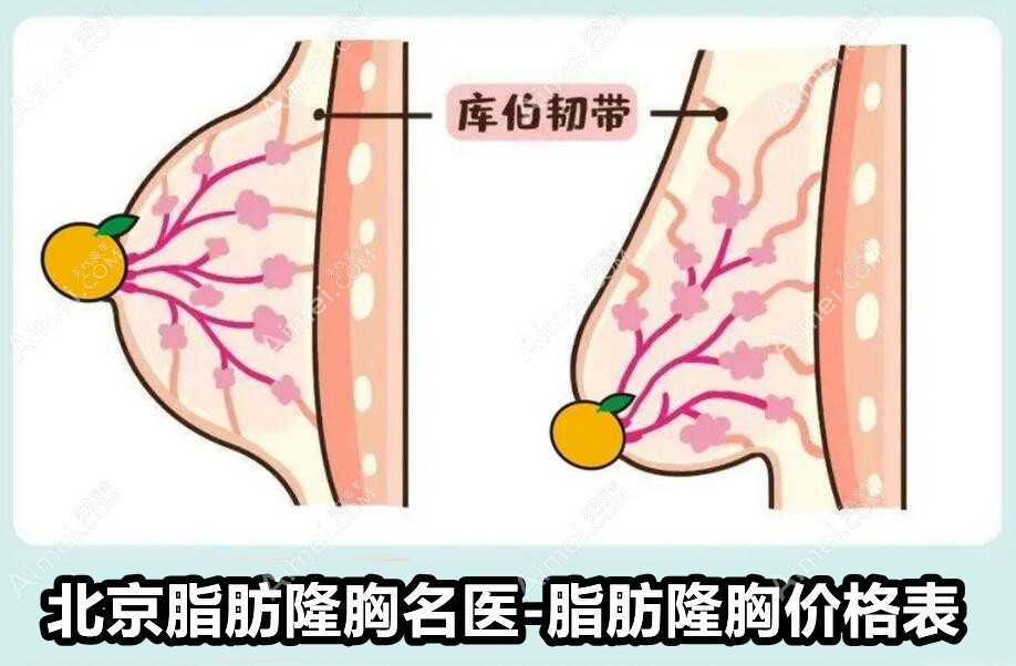 北京脂肪隆胸名医有：穆大力、刘成胜、王明利、乔爱军、冯斌等热门人物