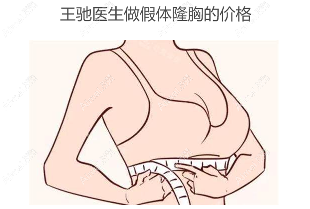 王驰医生做假体隆胸的价格 王驰医生做假体隆胸的价格