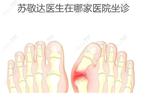 苏敬达医生在哪家医院坐诊 苏敬达医生在哪家医院坐诊