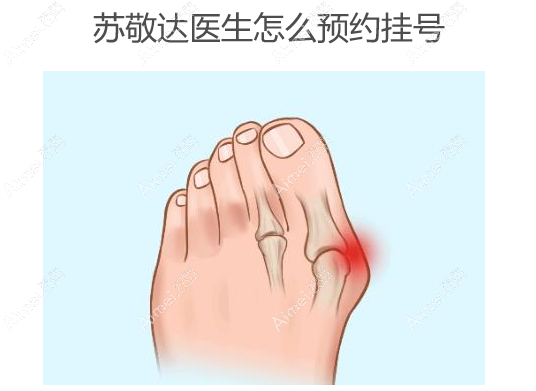 苏敬达医生怎么预约挂号 苏敬达医生怎么预约挂号