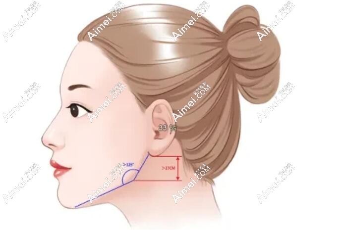 下颌角整形图片aimei.com