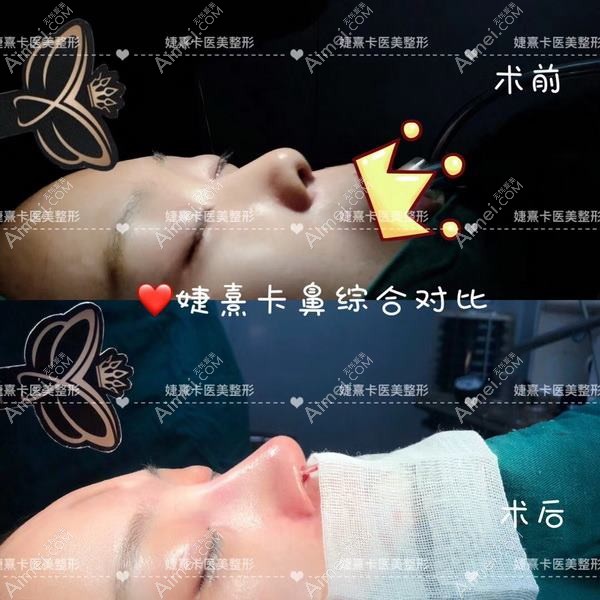 巫溪县悦己婕熹卡医疗美容诊所 巫溪县悦己婕熹卡医疗美容诊所