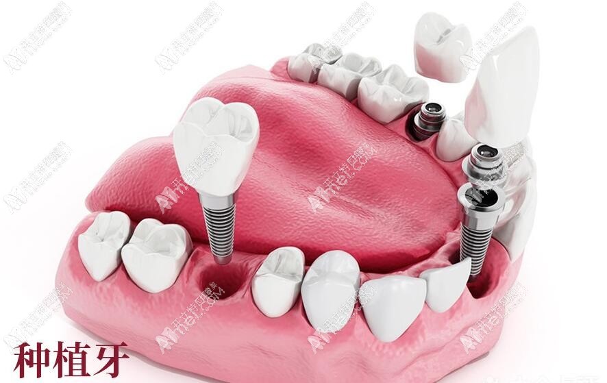 成都新桥口腔门诊部(光华店) 成都新桥口腔门诊部(光华店)