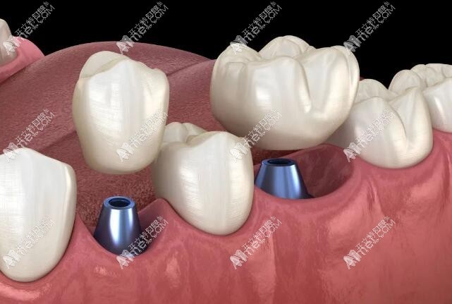 永州宁远齿晟口腔门诊部 永州宁远齿晟口腔门诊部