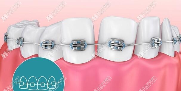 长沙好依生口腔门诊部 长沙好依生口腔门诊部