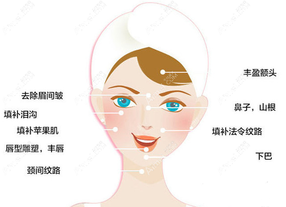 隋志甫医生擅长玻尿酸注射改善面部松弛 隋志甫医生擅长玻尿酸注射改善面部松弛