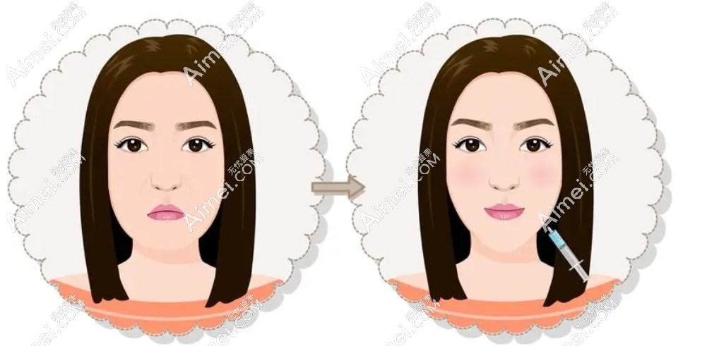艺星幼态脸打造成效好 m.aimei.com 艺星幼态脸打造成效好 m.aimei.com