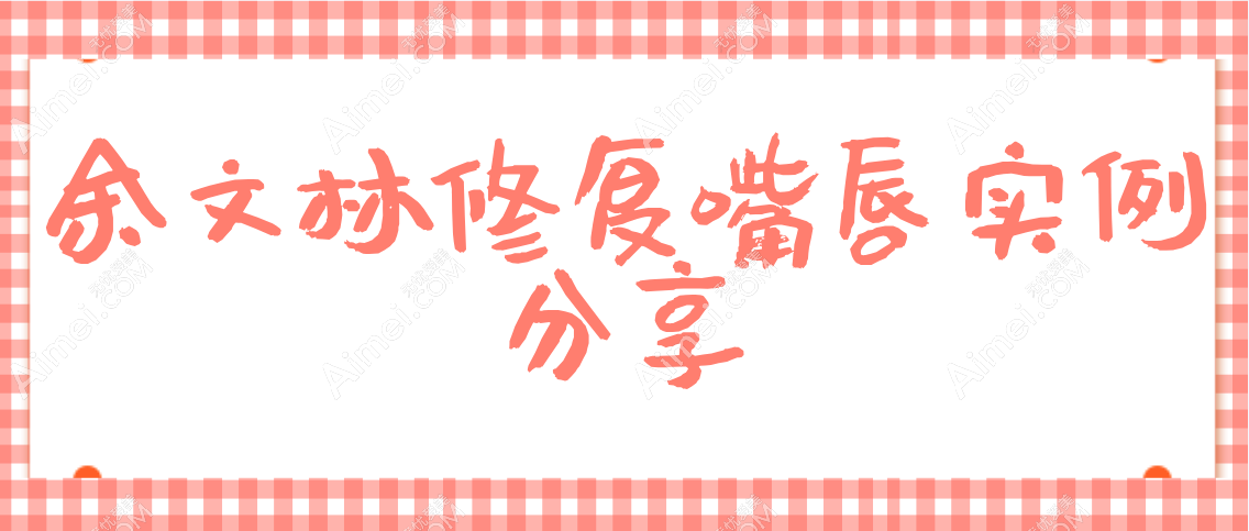 余文林修复嘴唇实例分享