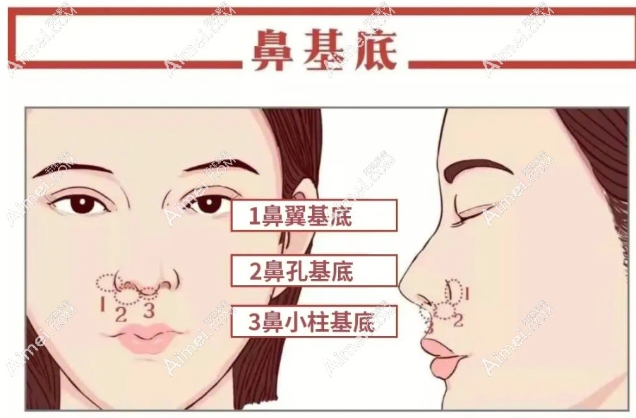 鼻基底填充会加速衰老吗?当然不会,同事说做完鼻基底像换了个人,我偷着乐
