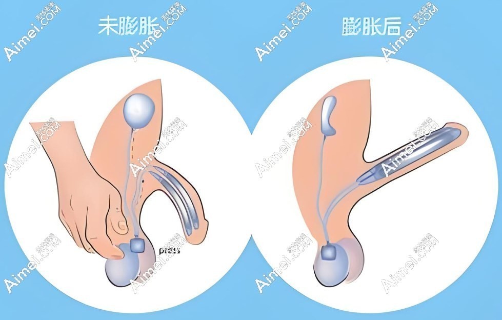 李世荣手术靠谱无失败实例 李世荣手术靠谱无失败实例