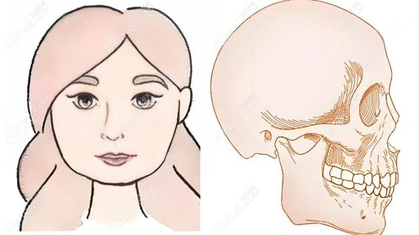 黄大勇磨骨贵吗 黄大勇磨骨贵吗