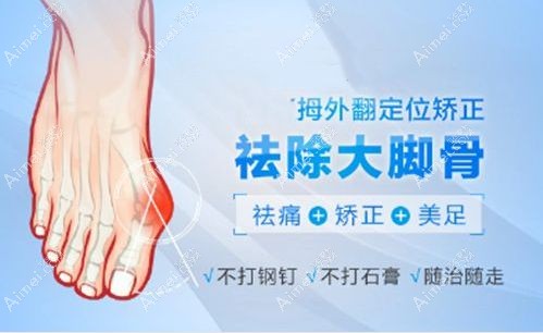 圣嘉新足雕技术靠谱