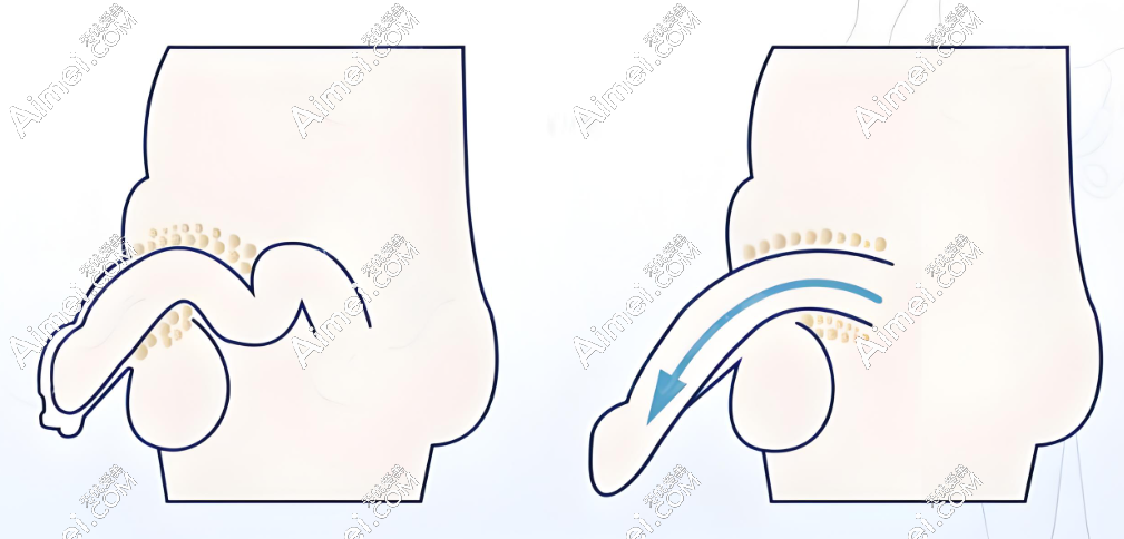 李世荣生殖器整形手术价格优惠大 m.aimei.com 李世荣生殖器整形手术价格优惠大 m.aimei.com
