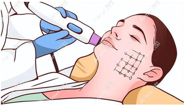 五代热玛吉认证医生 五代热玛吉认证医生