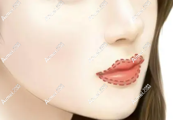 鄭永生醫(yī)生眼鼻嘴整形技術好