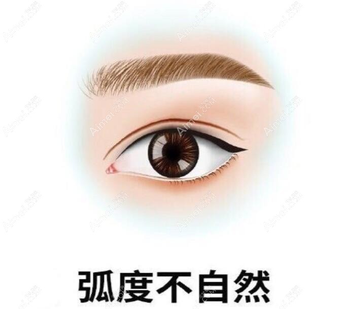 卢尚兵做过双眼皮的说说 卢尚兵做过双眼皮的说说